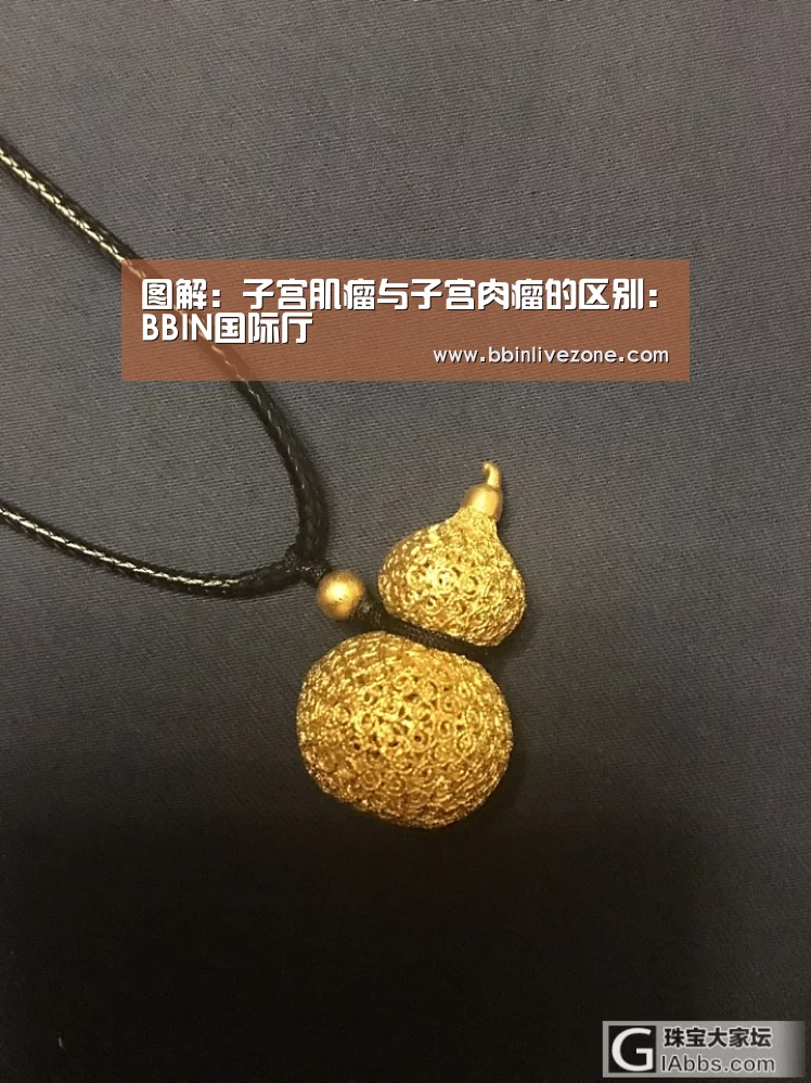 图解:子宫肌瘤与子宫肉瘤的区别:BBIN国际厅(图3) BBIN国际厅