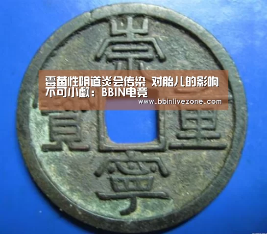 霉菌性阴道炎会传染 对胎儿的影响不可小觑:BBIN电竞(图4) BBIN国际厅